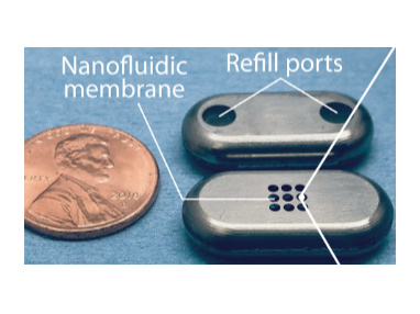 Refillable nanofluidic implant design shows the side with the loading/refill ports and the side with the drug-eluting membrane