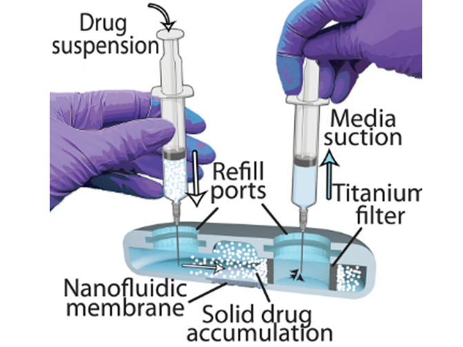 Cross section of implant illus-trating drug particle refilling